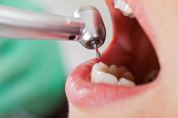 Best Dentist for Tooth Abscess  in North Grosvenor Dale, CT